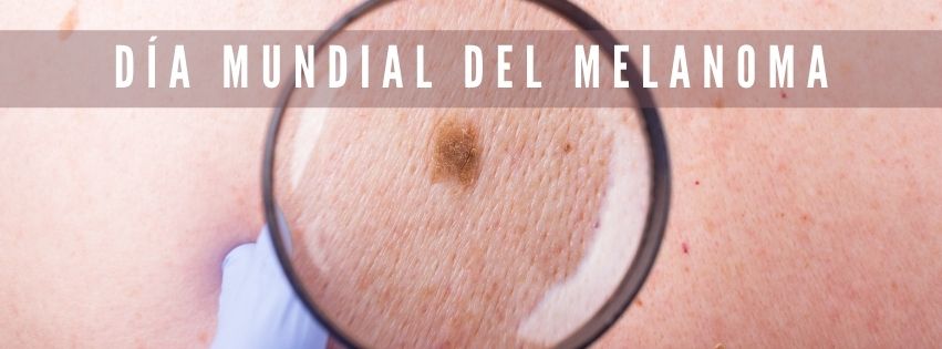 23 DE MAYO… DÍA MUNDIAL DEL MELANOMA