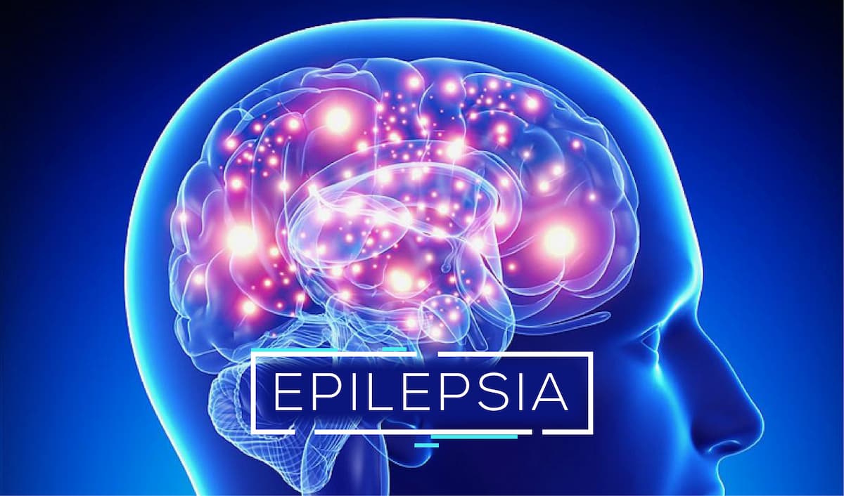 epilepsia
